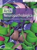 Acta Neuropathologica 4/2017