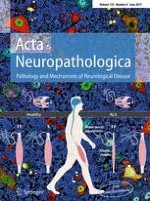 Acta Neuropathologica 6/2017