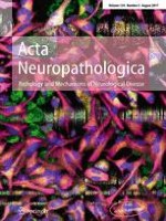 Acta Neuropathologica 2/2017