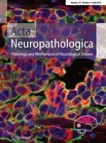 Acta Neuropathologica 4/2018