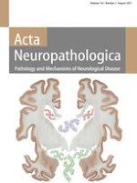 Acta Neuropathologica 2/2021