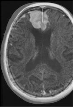 View full size image