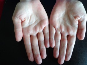 Dermatologische Diagnostik Dermatologische Diagnostik Springermedizin De