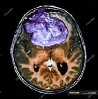 View full size image