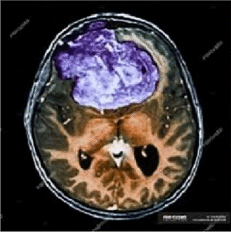 View full size image