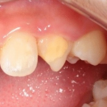 View full size image