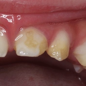 View full size image