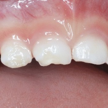 View full size image