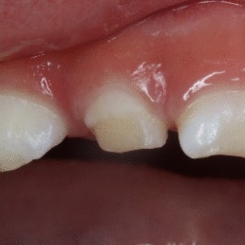 View full size image