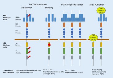 NSCLC | Biomarker MET in der Tumorpathologie | springermedizin.de