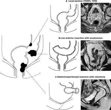 Umfrage zu Anatomie-Tools: 4. Draw it to Know it