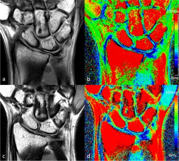 Thermal ablation with configurable shapes: a comprehensive