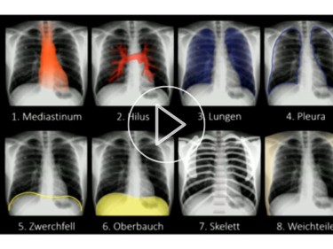 Diagnostische Radiologie Diagnostische Radiologie Springermedizin De