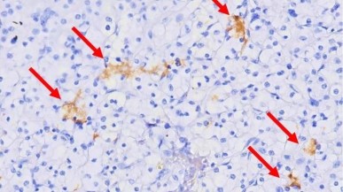 glp 1 temperature regulation Why Am I Cold on GLP-1 Medications? Causes and Solutions