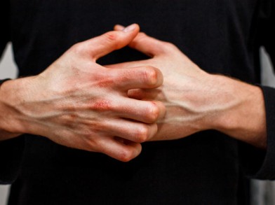 Rote Hände nach Sportaktivität? (Gesundheit und Medizin, Sport und Fitness,  Haut)