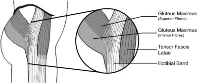 Renne's Test  Iliotibial Band Friction Syndrome ITBS 