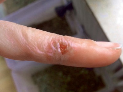 Auf welche Ursache zeigt dieser Finger?