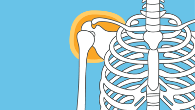 OP-Training - Schulter