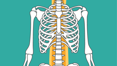 OP-Training - Wirbelsäule