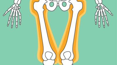 OP-Training - Oberschenkel