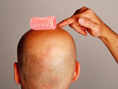 Zeigt Haarausfall das Risiko für Prostatakrebs an? (Symbolbild)