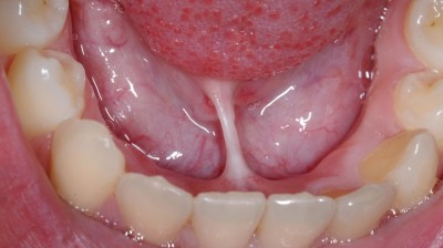 Kaakchirurgie Picture