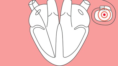 Schädelbasis