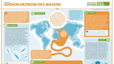 PrimeView Adenokarzinom des Magens