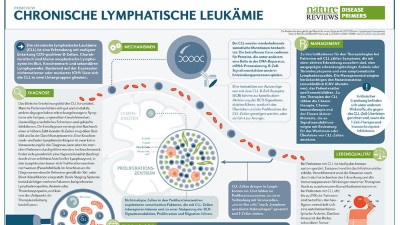 PrimeView Chronische lymphatische Leukämie