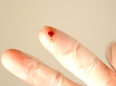 Blutstropfen auf Handschuh