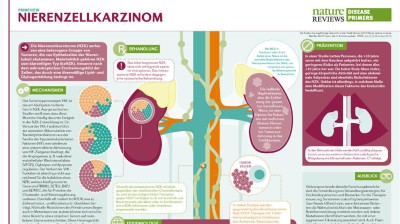 PrimeView Nierenzellkarzinom