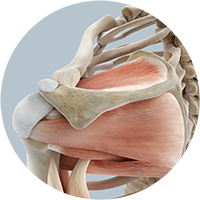 Schulter - Impingement