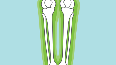 Knie & Unterschenkel