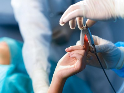 Fingerpulsoximeter bei Operation