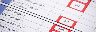 Laborwerte von LDL-Cholesterin