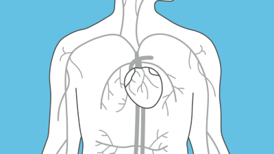 Angiologie