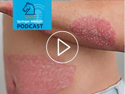 Podcast - Psoriasis