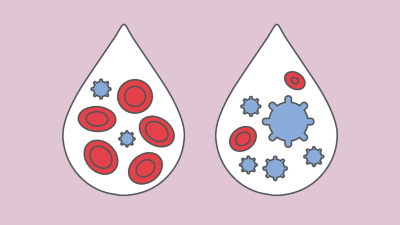 Hämatologische Neoplasien