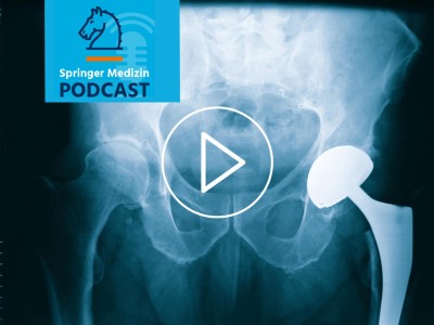 Podcast - Hüft-TEP