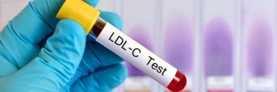 LDL-Cholesterin-Test