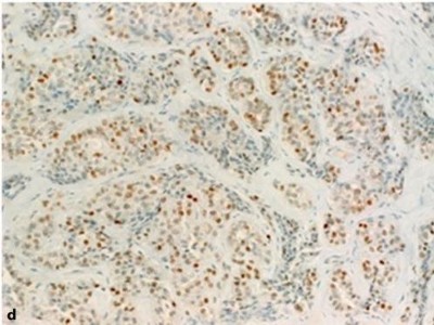 Histopathologisches Präparat