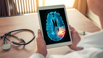 Arzt hält Tablet in der Hand mit einem radiologischen Gehirnbild