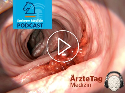 Podcast - Koloskopien 