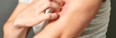 Eine Person, die sich juckt und kratzt