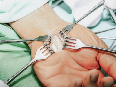 Operation Karpaltunnelsyndrom