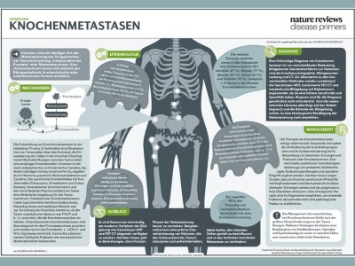 PrimeView Knochenmetastasen