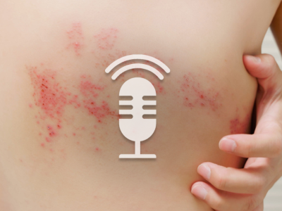 Springer Medizin Podcast - Zoster