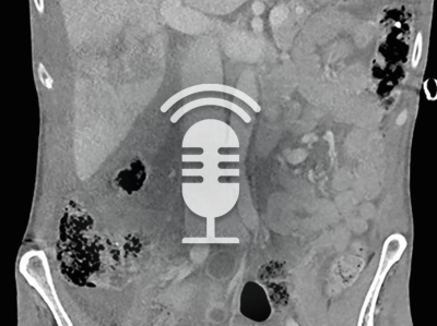 Springer Medizin Podcast – Notfall in der Viszeralchirurgie