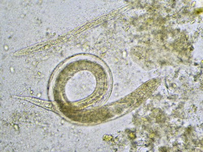 Mikroskopie einer Stuhlprobe: Strongyloides stercoralis