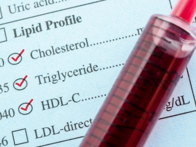 Lipidprofil